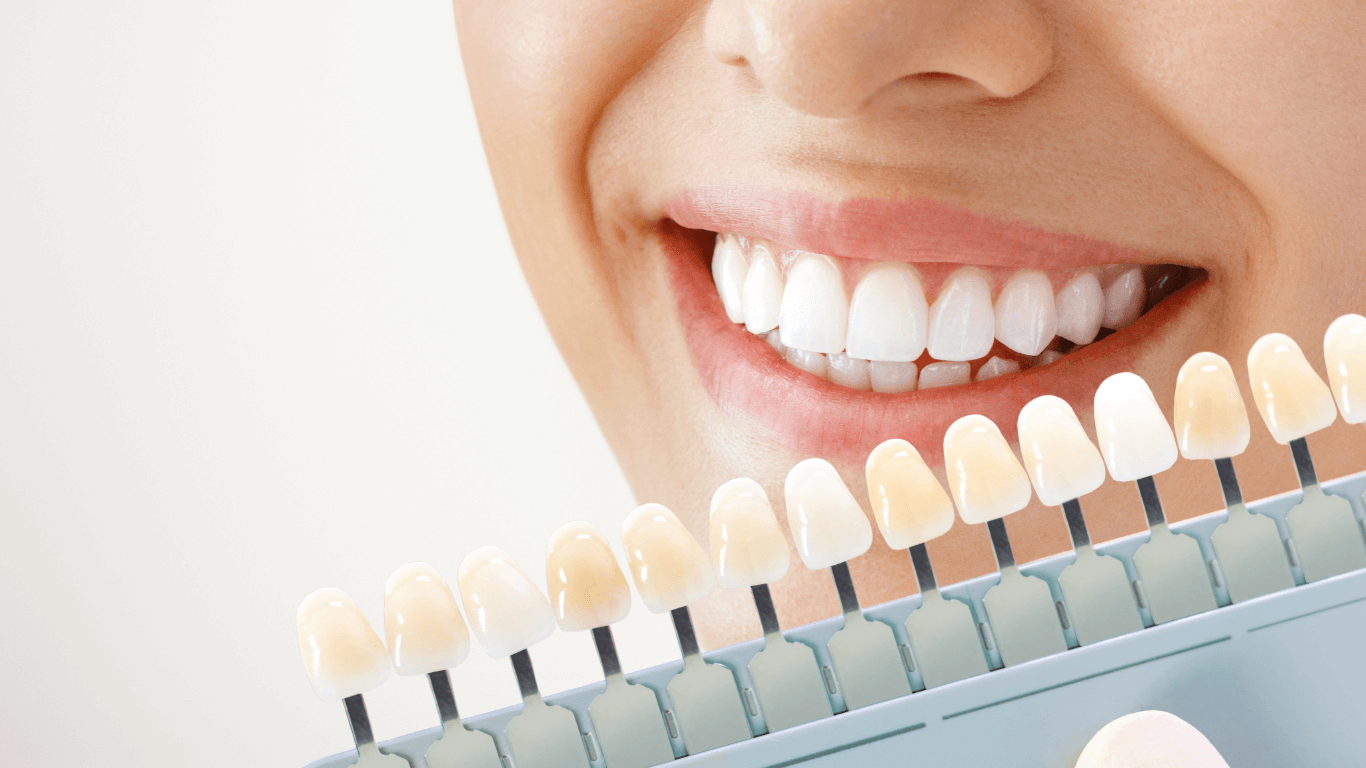 Teeth Whitening in Mumbai: Cost and Considerations